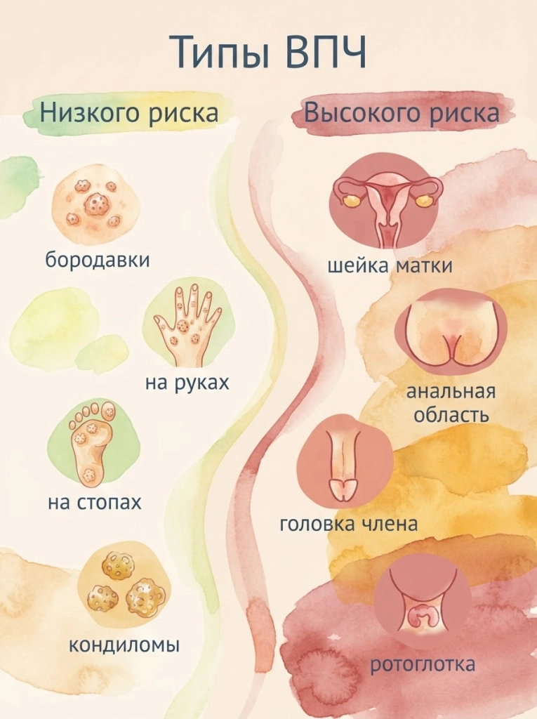 ВПЧ типы: низкого онкогенного риска (6, 11) и высокого (16, 18 и др.) — схема